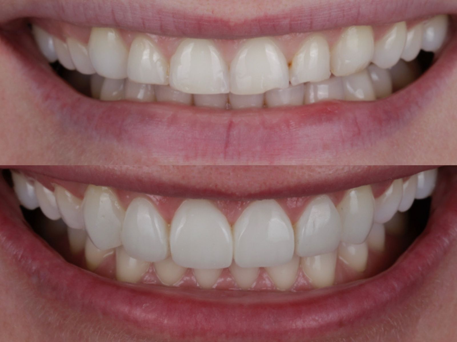 Fresh Dental case study photo 2