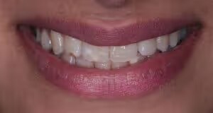 Zenab before