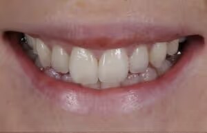 Samantha before