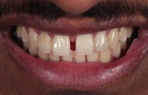 Tahir before