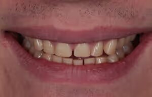 Olly before