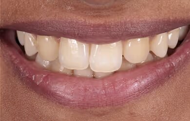 Sabina before