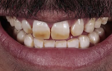 Juan before