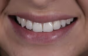 Rosalin after