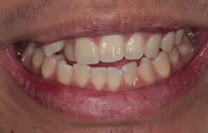 Daniel before