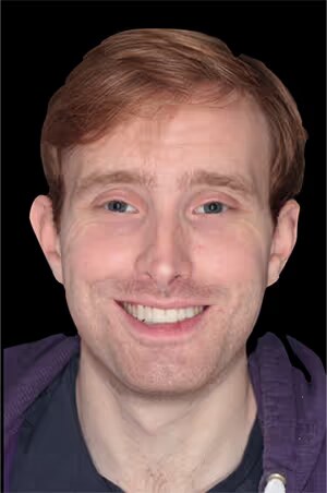 Invisalign