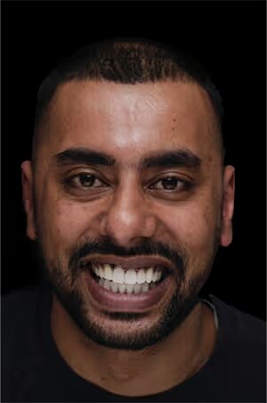 Umar