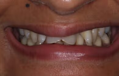 Jyoti before