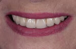 Doreen after treatment
