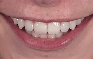 Macy after treatment