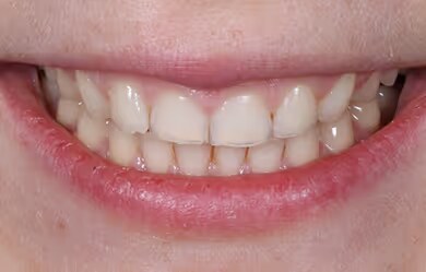 Ramona before