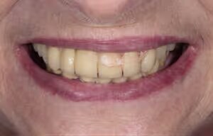 Doreen before