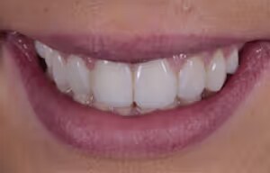 Jade after