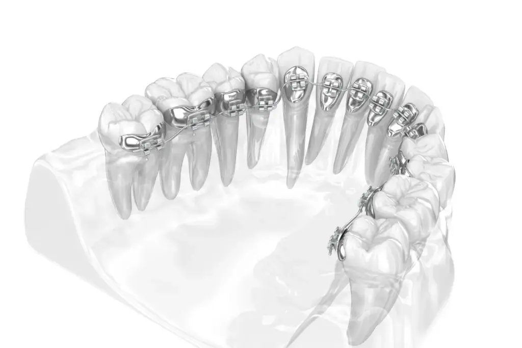 Choose an approach during dental treatment